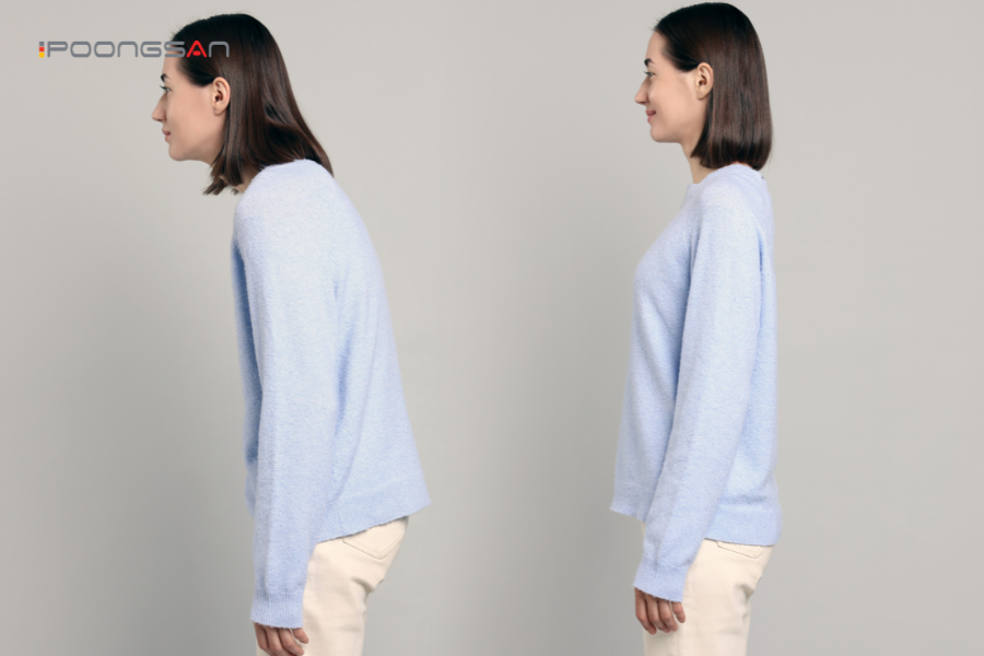 massage eo h&ocirc;ng cải thiện d&aacute;ng đứng